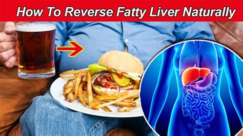 People with . . How long does it take to reverse fatty liver